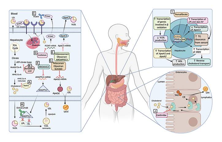 Novel Lipid Lowering Agents and Stroke PreventionNew Tools New Targets