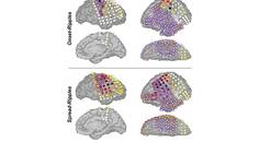 Epilepsy Essentials Novel Interictal Biomarkers for Delineating the Epileptogenic Zone in Children With Drug Resistant Epile