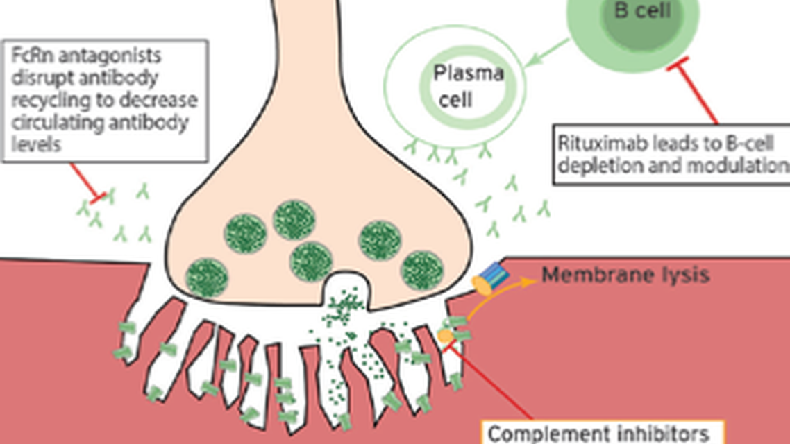 Neuromuscular Notes Next Generation Treatments for Myasthenia Gravis