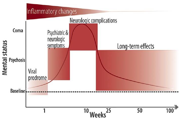 Anti N Methyl D Aspartate Receptor Encephalitis