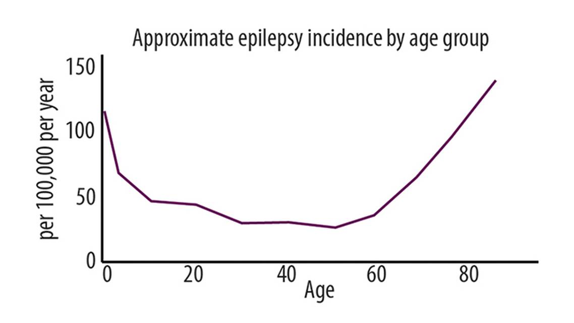Late Onset Epilepsy