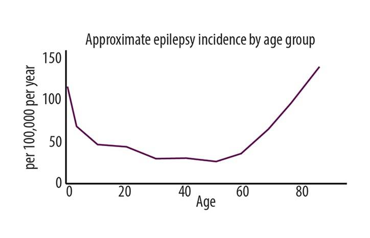 Diagnostic Considerations for New Onset Epilepsy in Older Adults