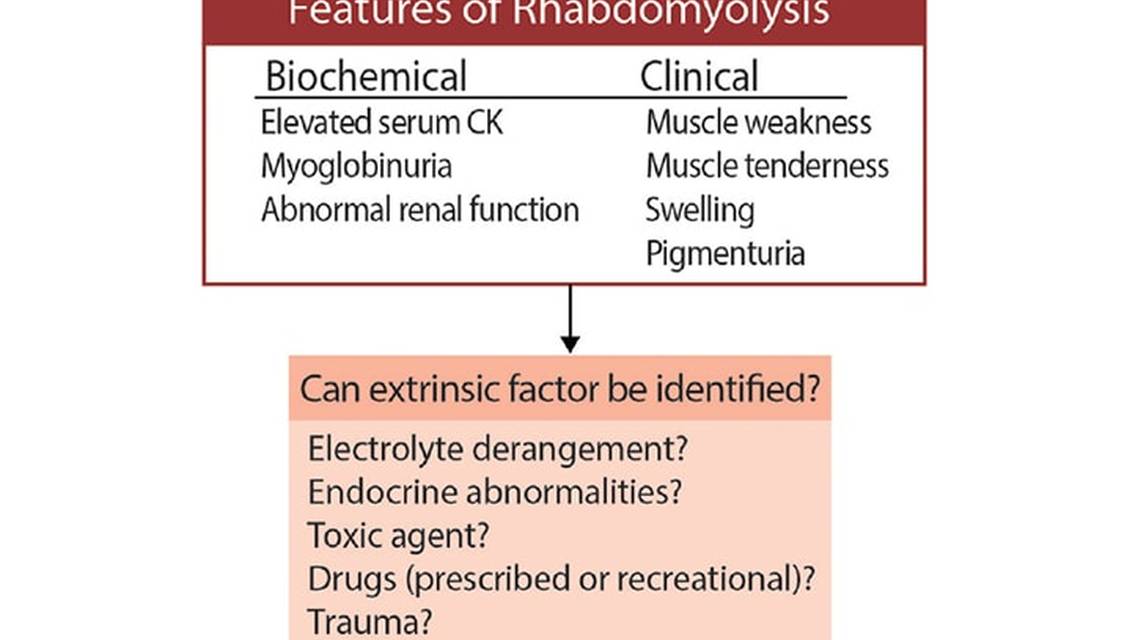 Neuromuscular Notes Rhabdomyolysis