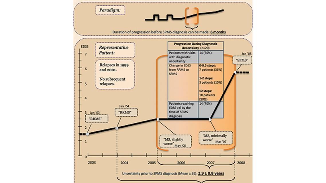 Contemporary Challenges in the Recognition Diagnosis and Management of Progressive Multiple Sclerosis