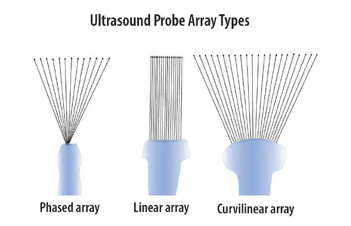 Point of Care Ultrasound for Outpatient Neurology