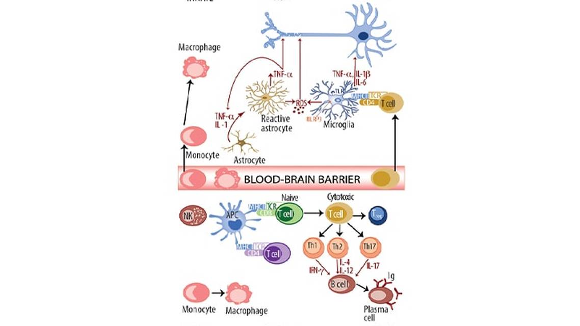 Neuroinflammation in Parkinson Disease