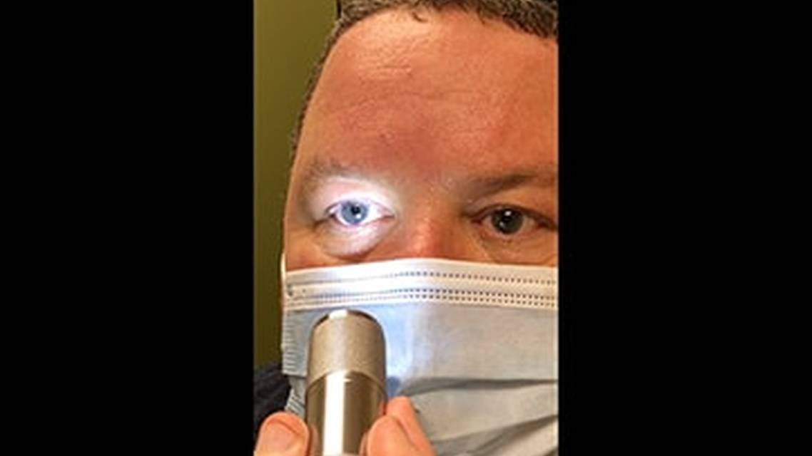 Pupillary Examination Thumb