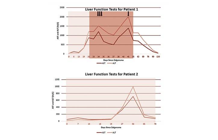 Case Report Elevated Transminases After Spinal Muscular Atrophy Treatment