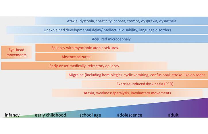 Toward Precision Medicine for Genetic Epilepsies Glucose Transporter Type 1 Deficiency Syndrome