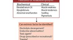 Neuromuscular Notes Rhabdomyolysis