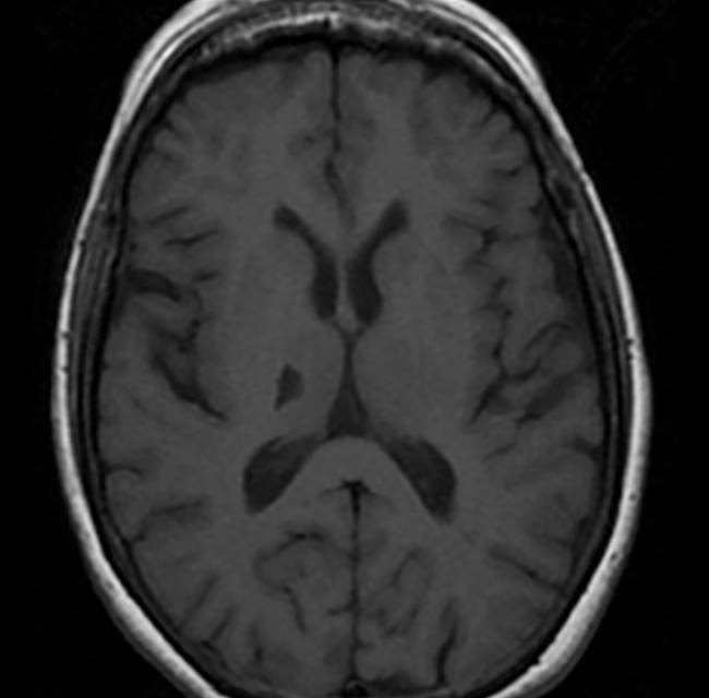 De Santis Fig 6