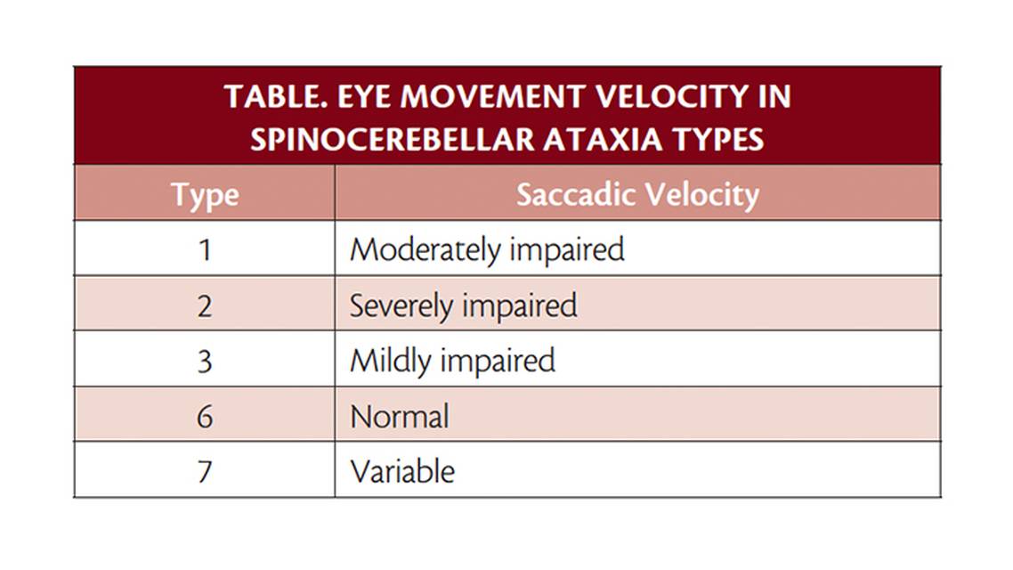 Movement Disorders Moment Neurodegenerative Spinocerebellar Ataxia