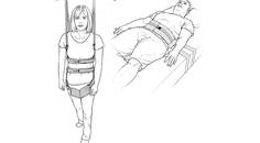 Epilepsy Essentials VideoEEG Monitoring