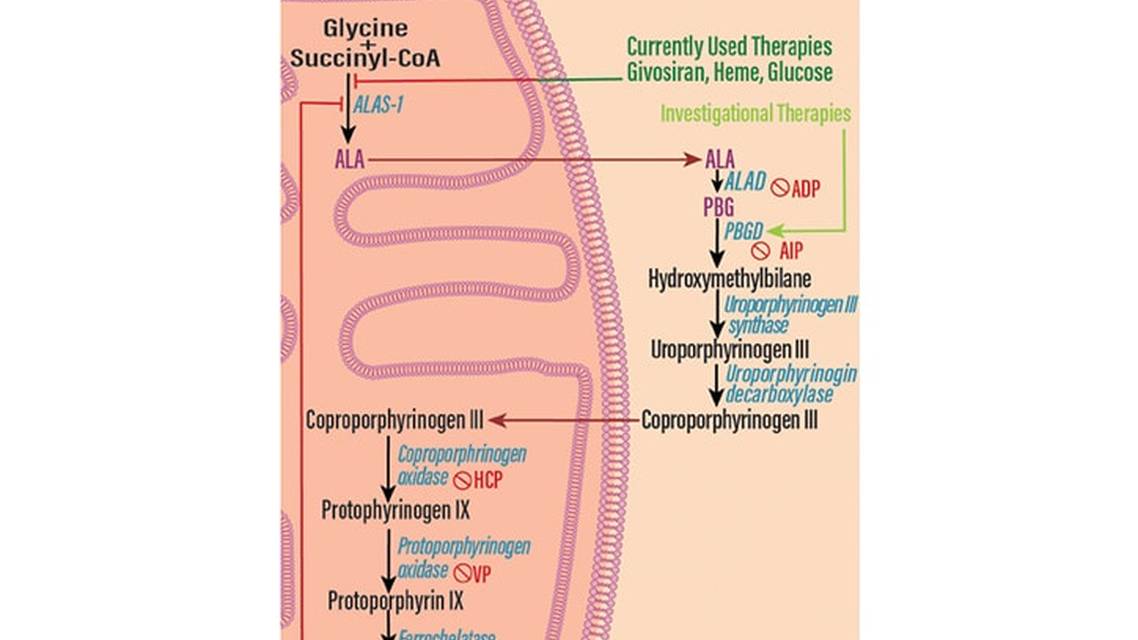Porphyric Neuropathy