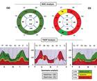 Neuromyelitis Optica Spectrum Disorder in Castleman Disease
