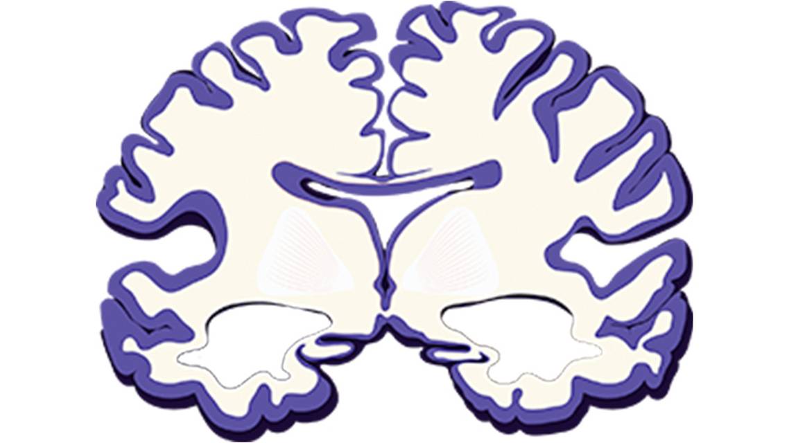 The Future of Alzheimer Disease Care Depends on Early Diagnosis