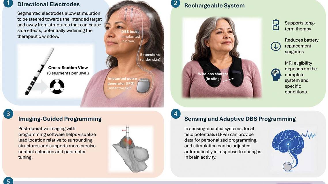 The New Era of Deep Brain Stimulation Programming in Parkinson Disease