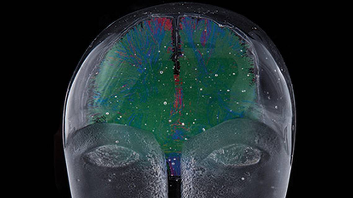 Pediatric Traumatic Brain Injury