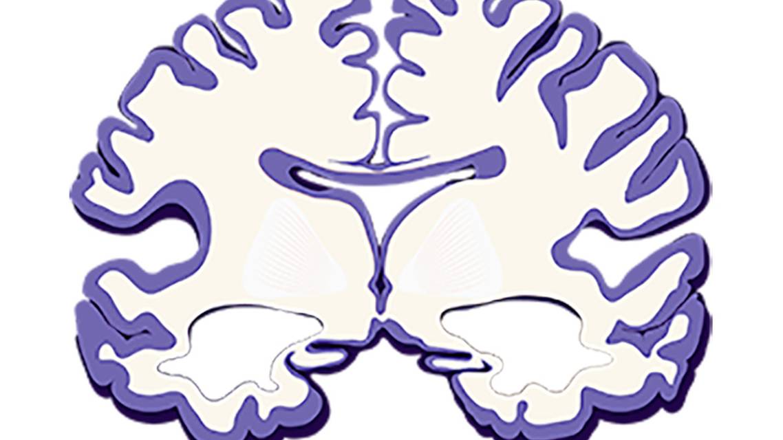 Potential Uses of ATXN Classification of Alzheimer Disease