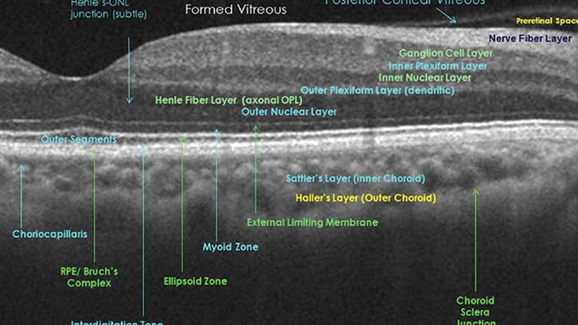 Optical Coherence Tomography and Neurology