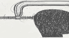 Severe Inflammatory Response Causing Choroid Plexitis and Acute Hydrocephalus in a Patient with Hodgkins Lymphoma A Case Re