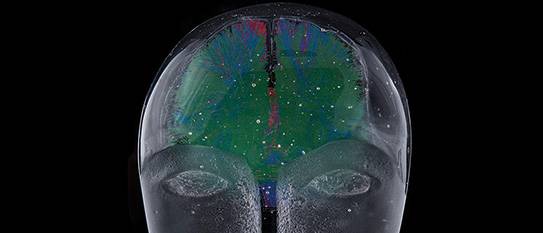 Pediatric Traumatic Brain Injury