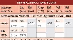 Peripheral Neuropathy Caused by Vitamin B12 Deficiency
