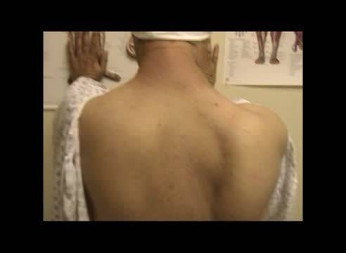 September 2015 Case Challenge Scapular Winging After Cervical Lymph Node Biopsy thumbnail