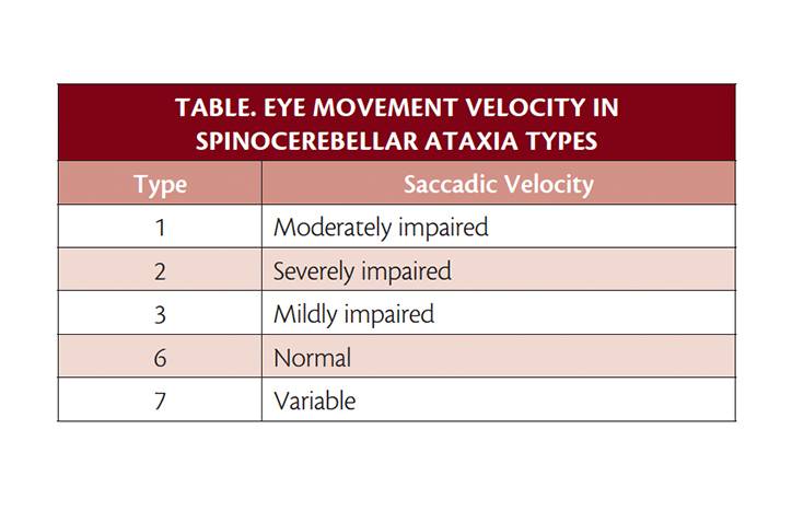 Movement Disorders Moment Neurodegenerative Spinocerebellar Ataxia