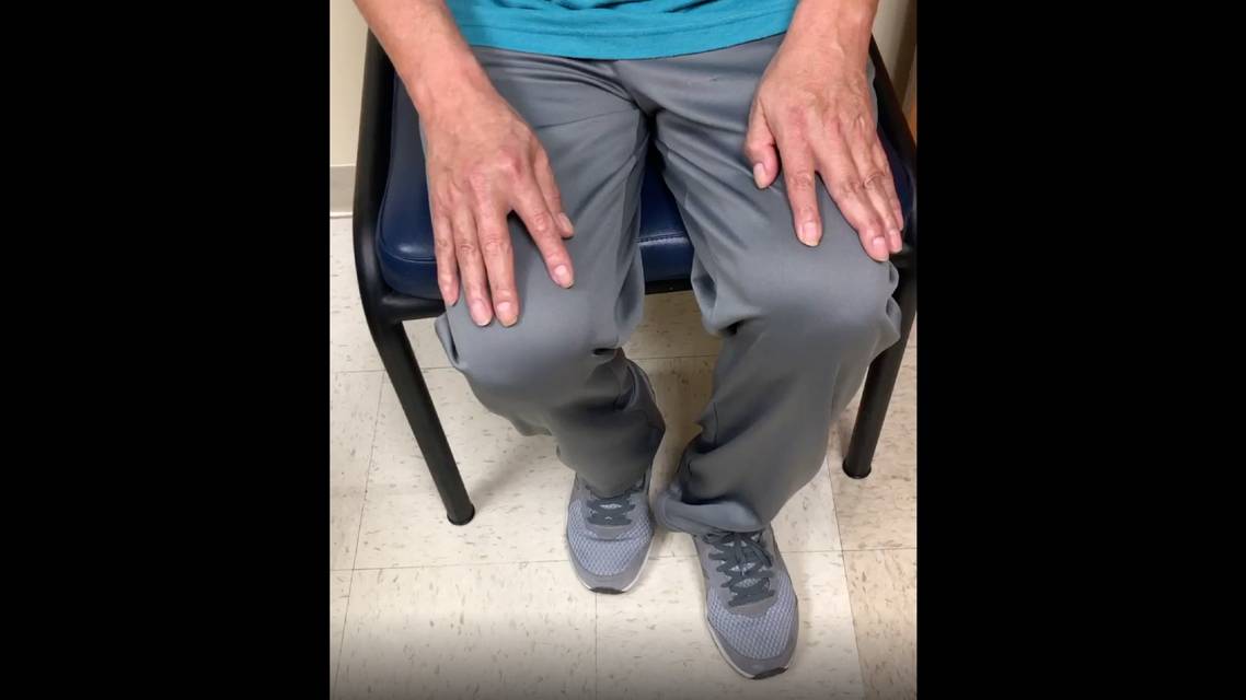 Leftsided Hemiparesis With RightSided Tremor thumbnail