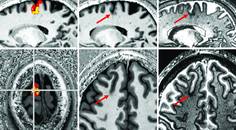 Figure 1 from the Epilepsy Essentials column article by Drs Ekert and Middlebrooks