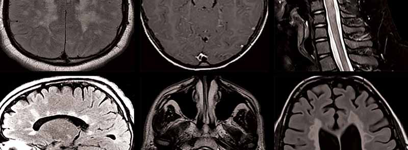 A Coming of Age for Neuroimmunology