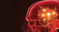 Action Tremor and Gait Imbalance With Eventual Cognitive Decline