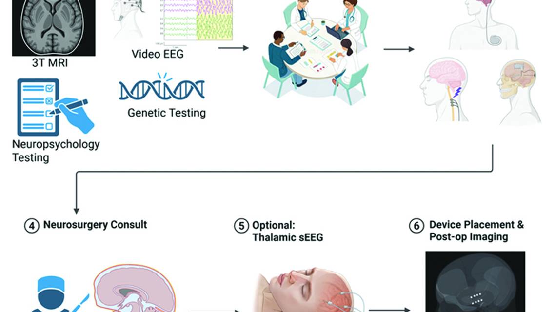 Figure 1 from the article by Dr Edmond appearing in the November 2025 issue of Practical Neurology