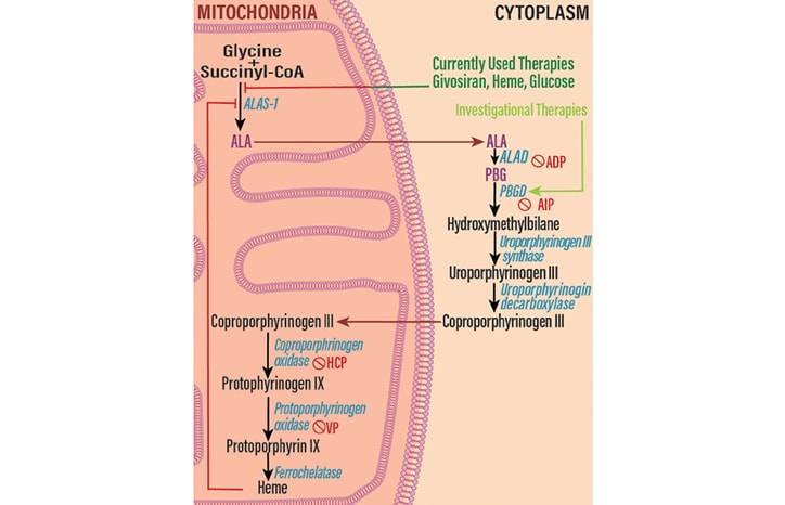Porphyric Neuropathy