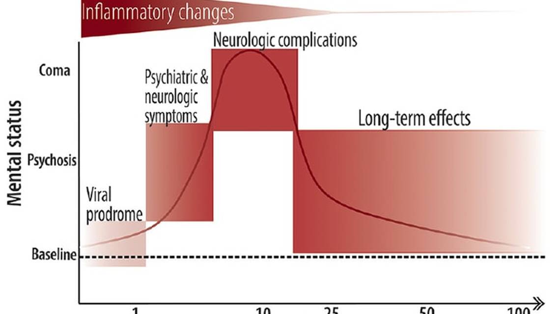 Anti N Methyl D Aspartate Receptor Encephalitis