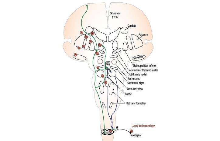 Movement Disorders Moment Pain and Palliative Care in Movement Disorders