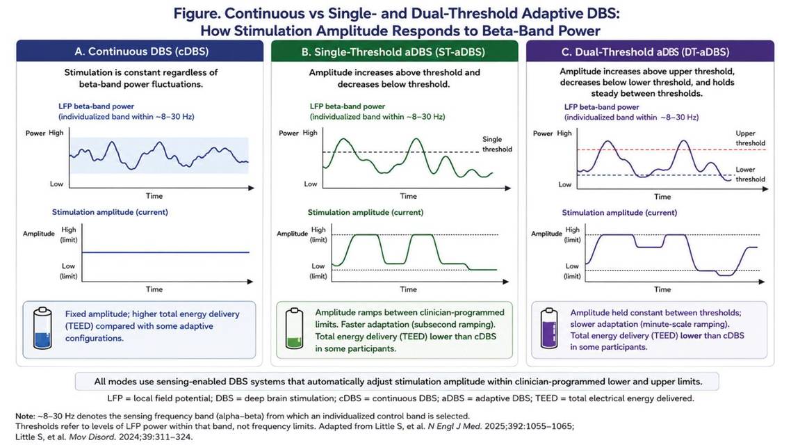 Figure 1 from Dr Khemanis article depicting an infographic about continuous vs adaptive DBS