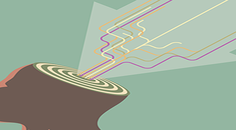 Dropped Head Syndrome