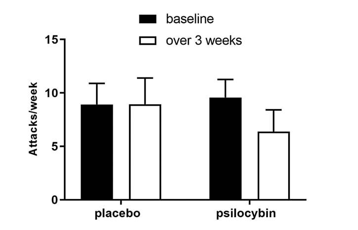 Headache Horizons The Study and Use of Psychedelics in Cluster Headache