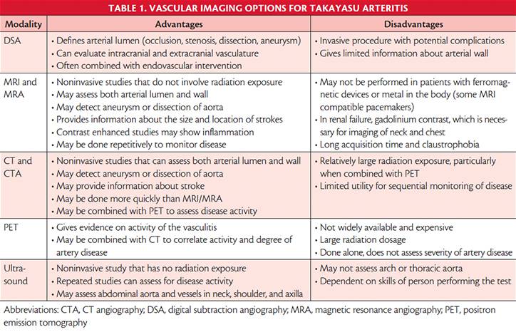 Takayasu Disease and Stroke