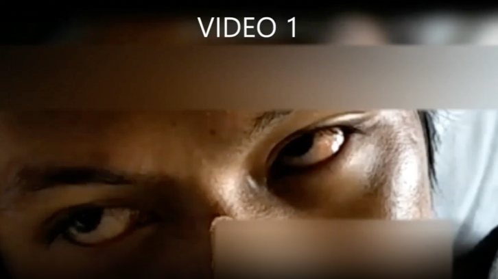 Ocular bobbing in eosiniphilic meningitis thumbnail