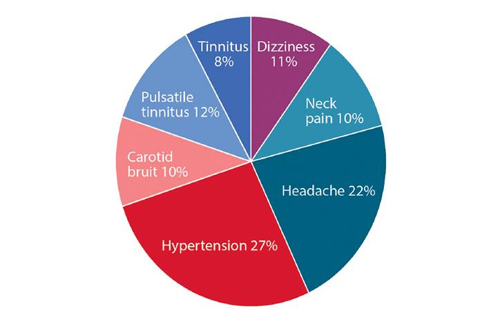 Fibromuscular Dysplasia and Stroke