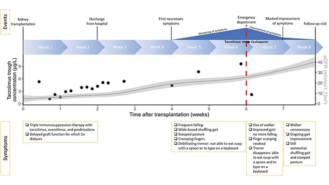 Severe Calcineurin Inhibitor Induced Parkinsonism After Kidney Transplantation