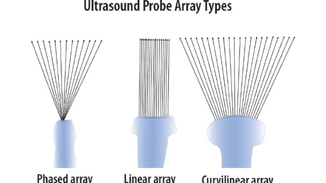 Point of Care Ultrasound for Outpatient Neurology