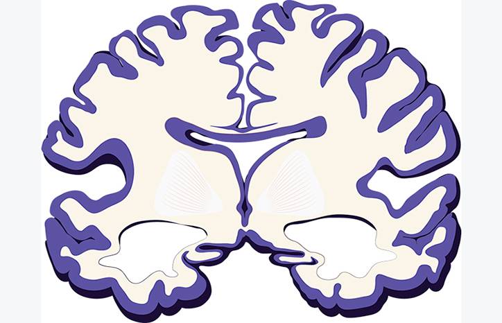 Diversity in Aging Related Neuroimaging Research