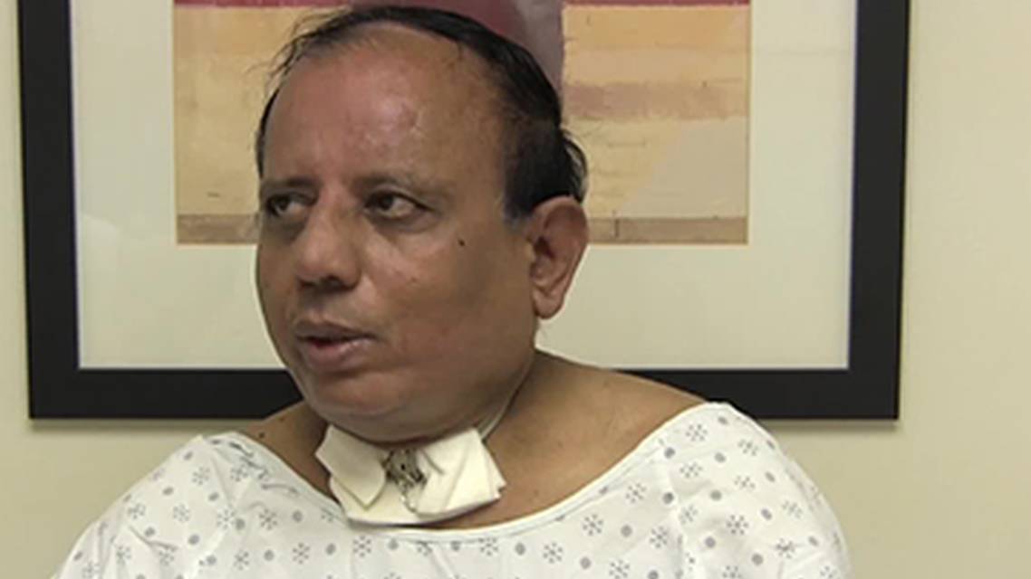 Chronic Facial Weakness and Deafness