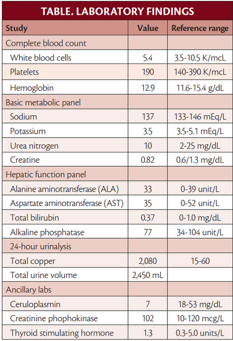 Wilson Disease - Wilson Disease -