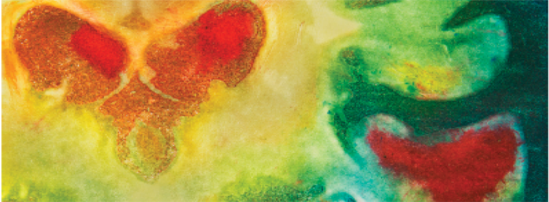 New American Academy of Neurology Disease Modifying Treatment Guidelines Impact on Clinical Practice