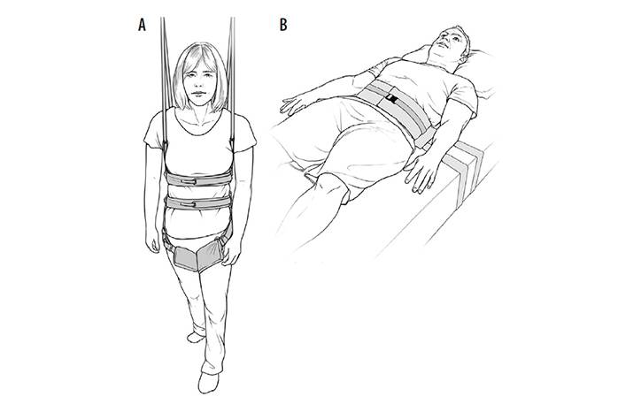 Epilepsy Essentials VideoEEG Monitoring